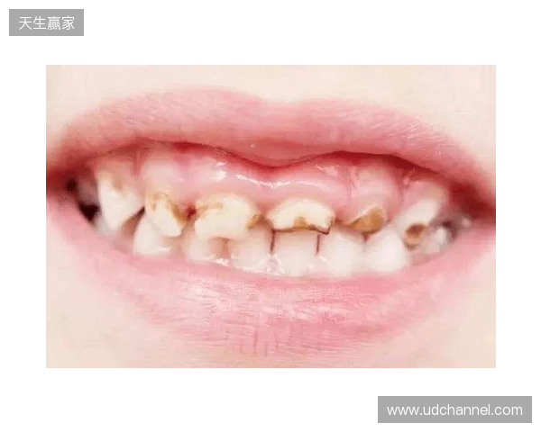 韦林顿确诊上唇部贯通伤;11、21牙半脱位;上颌前牙区牙槽骨骨折 韦林顿确诊上唇部贯通伤;11、21牙半脱位;上颌前牙区牙槽骨骨折